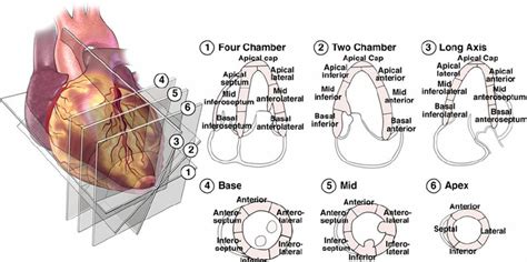 lv segments echo|17 segments of the heart.